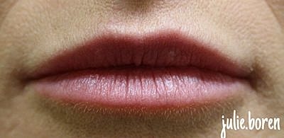 Lip Filler Before & After